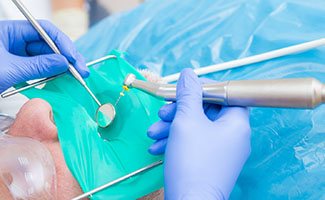 Root canal therapy in Ocala
