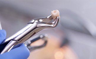 Forceps holding extracted tooth on gray background