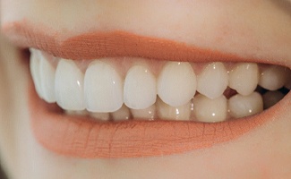 Closeup of smiling patient with dental bridge in Ocala