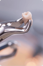 A tooth in a set of pliers