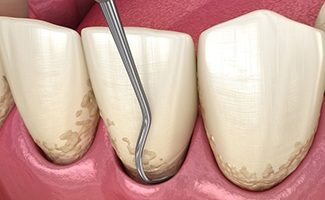 Illustration of scaling process