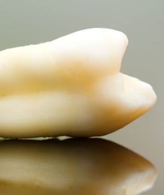 an extracted tooth