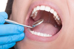 Your dentist in Ocala provides comprehensive preventive dental services. 