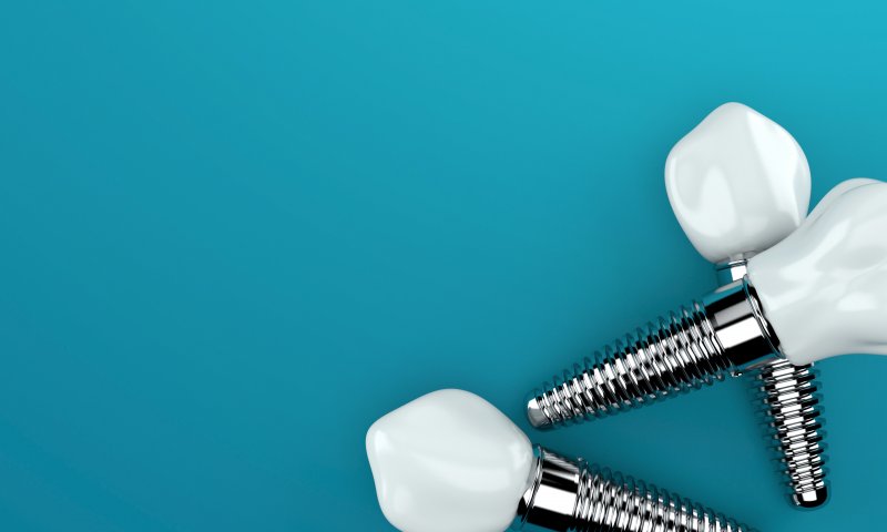 A close-up of dental implants in Ocala