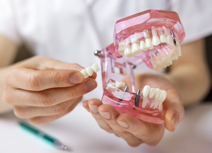 Dentist holding a model dental bridge